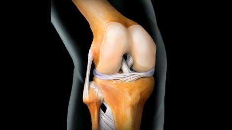 Пациентка премина успешно през рядка и високоспециализирана ревизионна операция в Еврохоспитал&nbsp;Пловдив